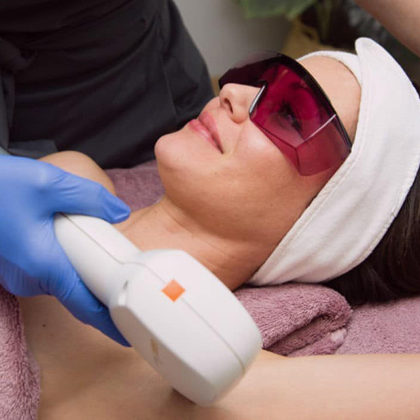 Epilation-Laser-Regeneva1