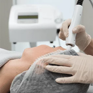 Microdermabrasion