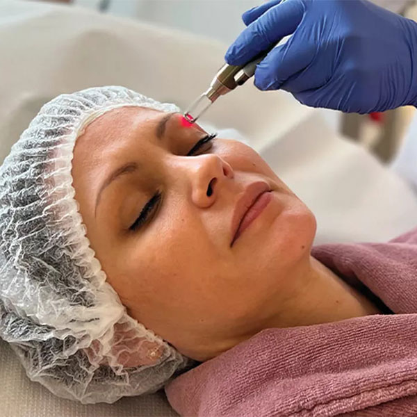 Banniere-laser-Silkplex