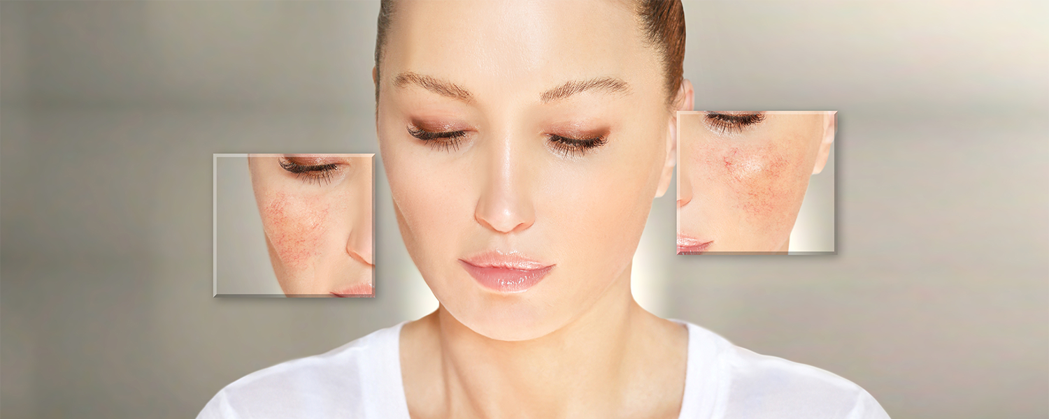 Anomalies vasculaires Genève