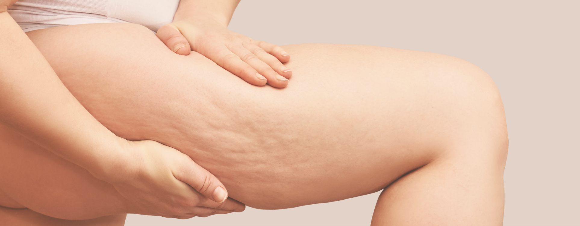 Cellulite et capitons