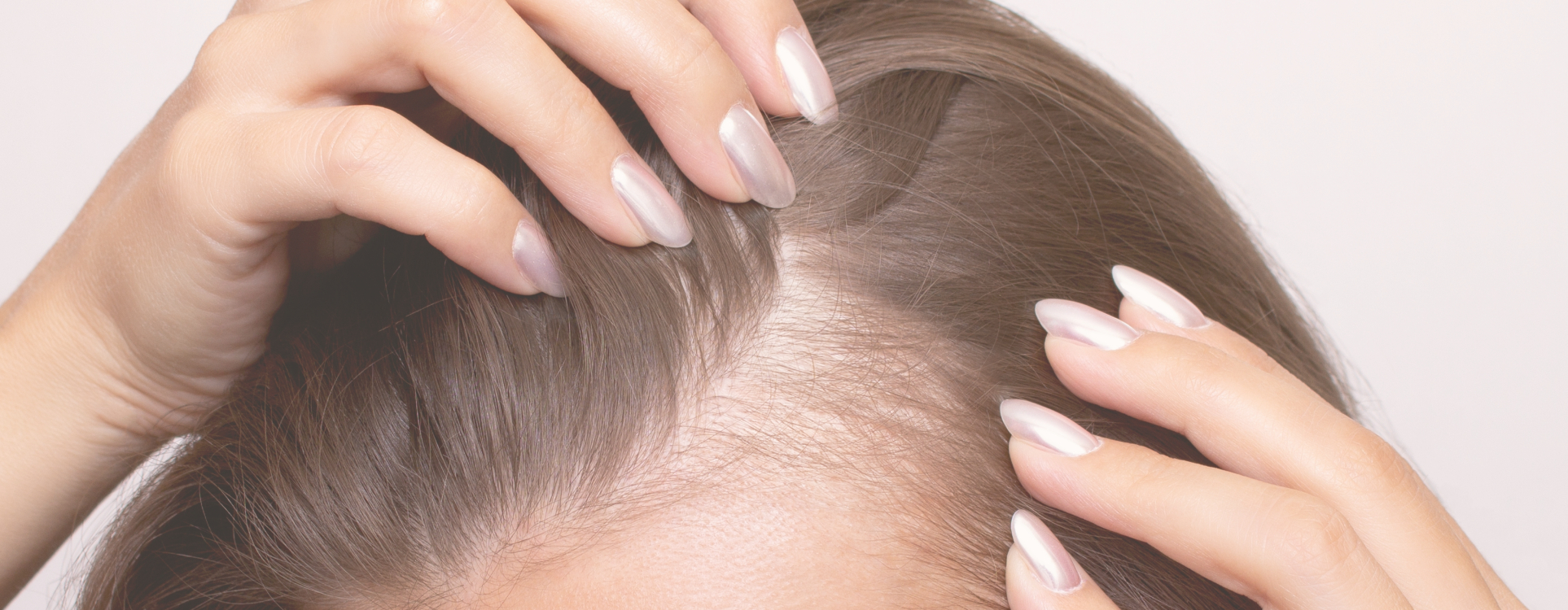 chute de cheveux Genève