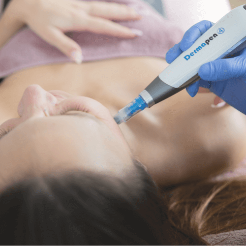 Microneedling Genève