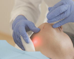 Endolift_ReGeneva_Banniere_300x328