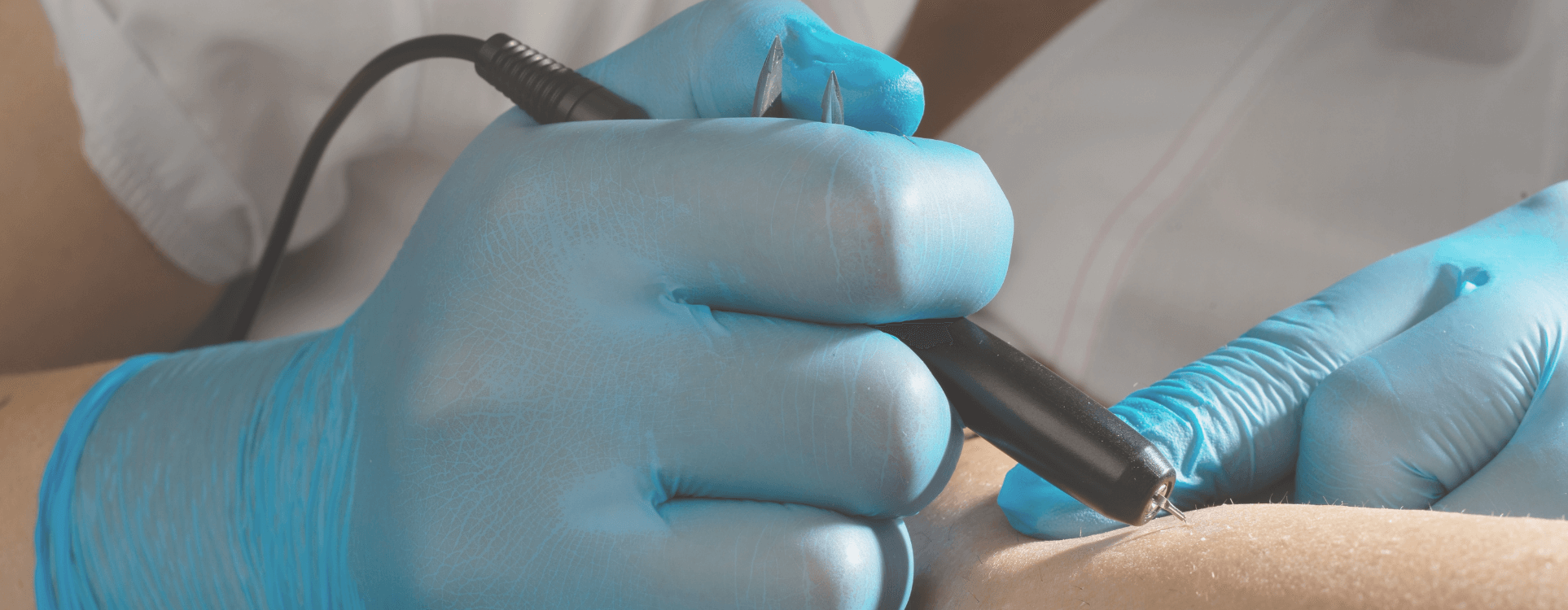 Epilation par électrolyse Genève