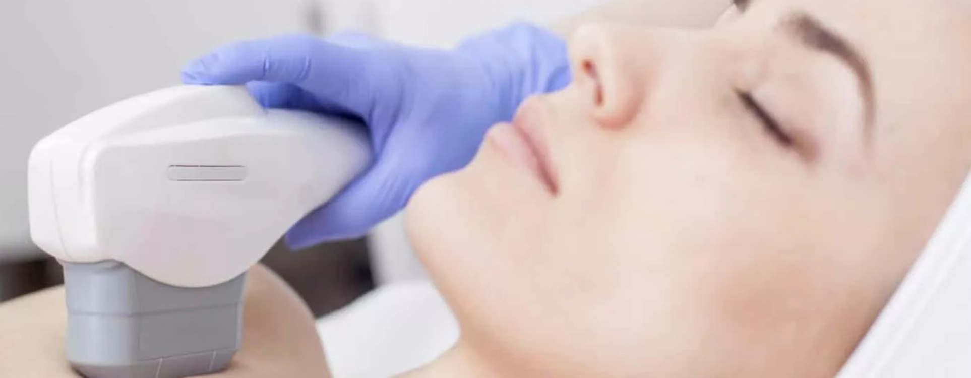 traitement des tâches pigmentaire IPL Genève