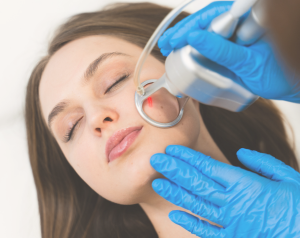 Laser_CO2_ReGeneva_Banniere_300x238