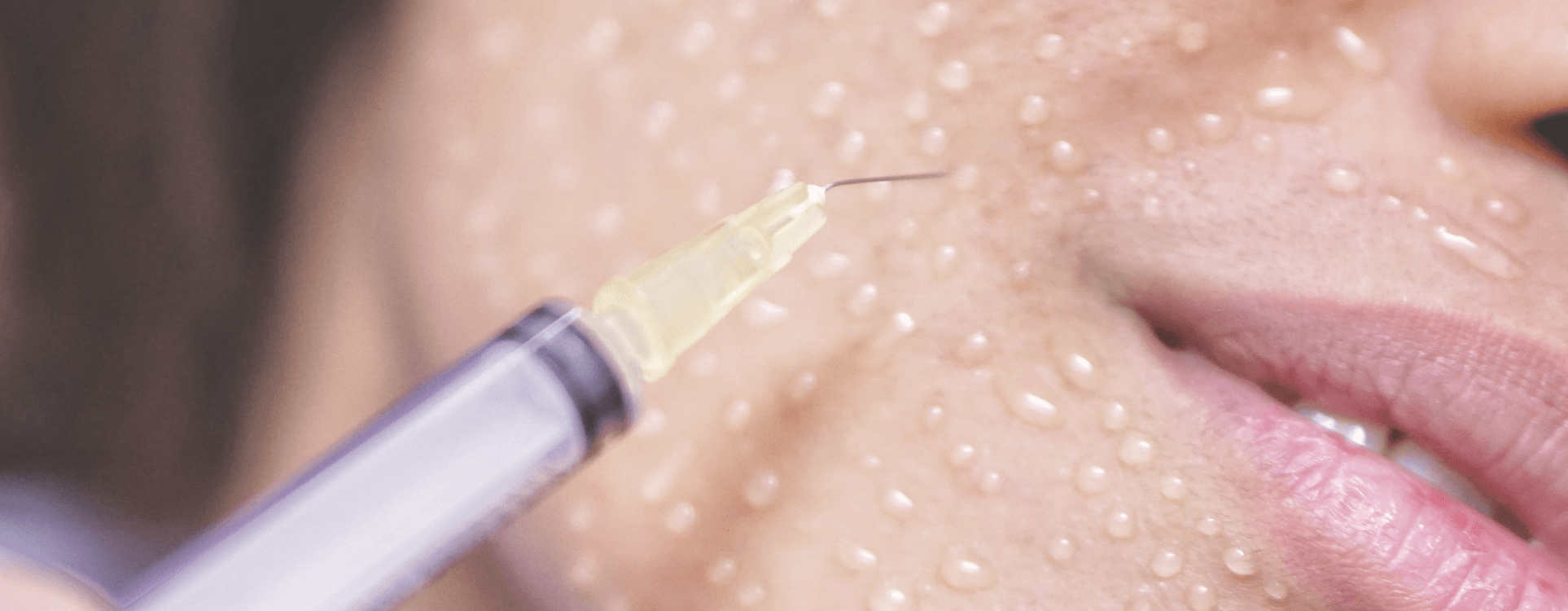 Mésothérapie profonge Genève
