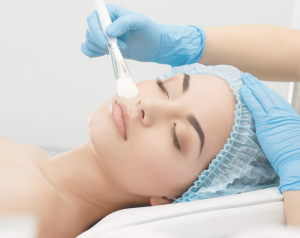 Peeling_Medicaux_ReGeneva_Banniere_300x238