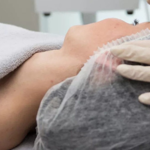 Microdermabrasion Genève