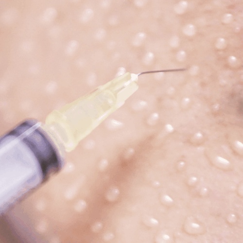 Mésothérapie profonde