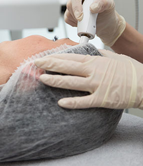 Microdermabrasion