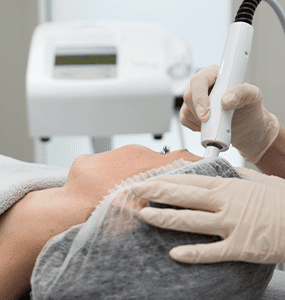 Microdermabrasion