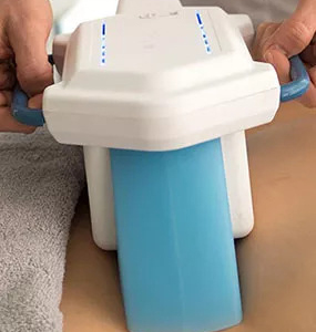 Cryolipolyse