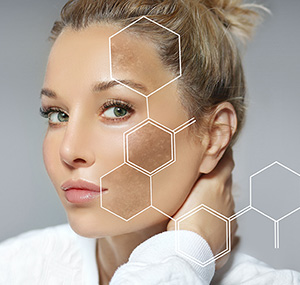 Melasma et Taches Pigmentaires mob