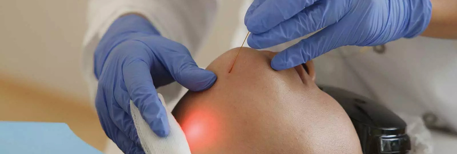 Endolift