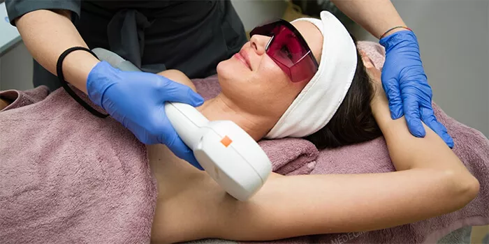 Epilation laser Epilation laser